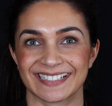 Smile Gallery - Church Road Dental and Cosmetic