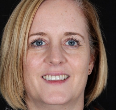 Smile Gallery - Church Road Dental and Cosmetic