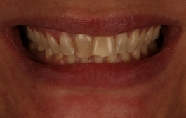 Smile Gallery - Church Road Dental and Cosmetic