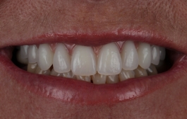 Smile Gallery - Church Road Dental and Cosmetic