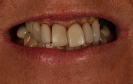 Smile Gallery - Church Road Dental and Cosmetic