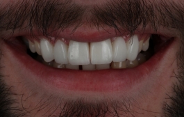 Smile Gallery - Church Road Dental and Cosmetic