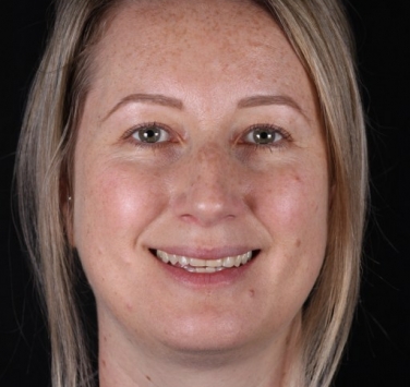 Smile Gallery - Church Road Dental and Cosmetic