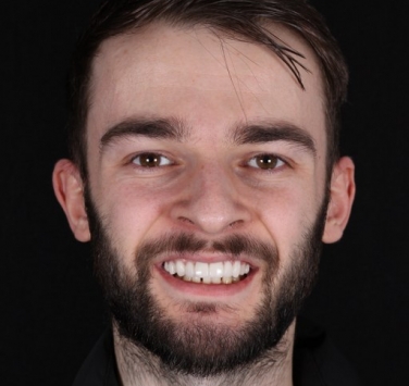 Smile Gallery - Church Road Dental and Cosmetic