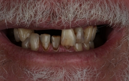 Smile Gallery - Church Road Dental and Cosmetic