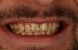 Smile Gallery - Church Road Dental and Cosmetic