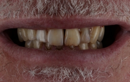 Smile Gallery - Church Road Dental and Cosmetic