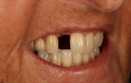 Smile Gallery - Church Road Dental and Cosmetic