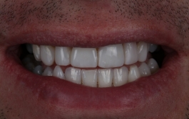 Smile Gallery - Church Road Dental and Cosmetic