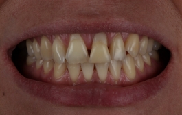 Smile Gallery - Church Road Dental and Cosmetic