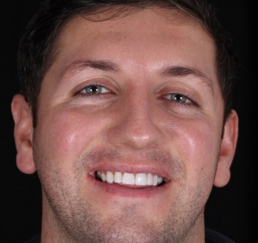 Smile Gallery - Church Road Dental and Cosmetic