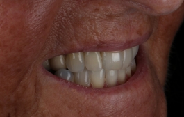 Smile Gallery - Church Road Dental and Cosmetic