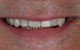 Smile Gallery - Church Road Dental and Cosmetic