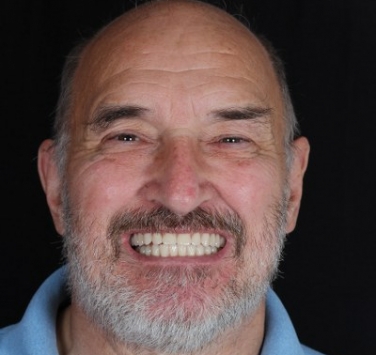 Smile Gallery - Church Road Dental and Cosmetic