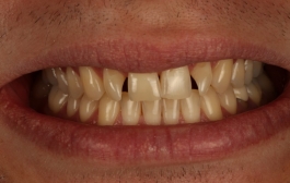 Smile Gallery - Church Road Dental and Cosmetic