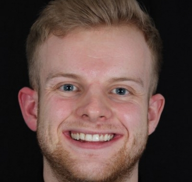 Smile Gallery - Church Road Dental and Cosmetic