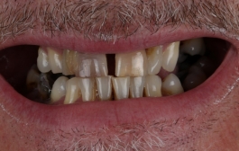 Smile Gallery - Church Road Dental and Cosmetic