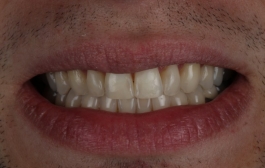 Smile Gallery - Church Road Dental and Cosmetic