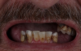 Smile Gallery - Church Road Dental and Cosmetic