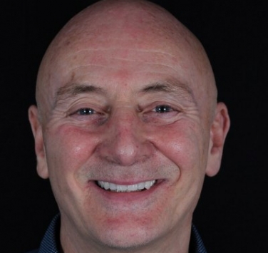 Smile Gallery - Church Road Dental and Cosmetic