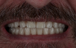 Smile Gallery - Church Road Dental and Cosmetic