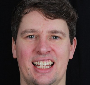 Smile Gallery - Church Road Dental and Cosmetic