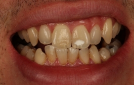 Smile Gallery - Church Road Dental and Cosmetic
