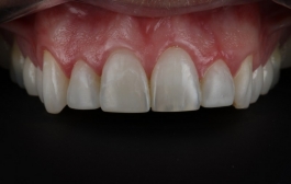 Smile Gallery - Church Road Dental and Cosmetic