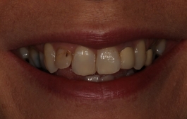 Smile Gallery - Church Road Dental and Cosmetic