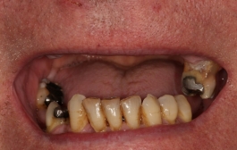 Smile Gallery - Church Road Dental and Cosmetic