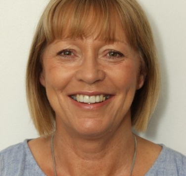 Smile Gallery - Church Road Dental and Cosmetic