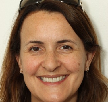 Smile Gallery - Church Road Dental and Cosmetic