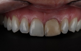 Smile Gallery - Church Road Dental and Cosmetic