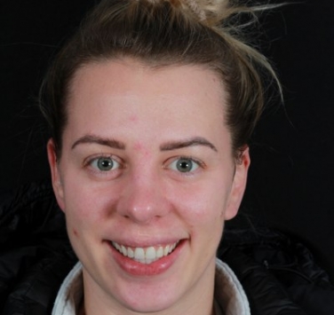 Smile Gallery - Church Road Dental and Cosmetic