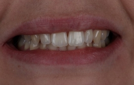 Smile Gallery - Church Road Dental and Cosmetic