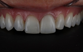 Smile Gallery - Church Road Dental and Cosmetic