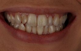 Smile Gallery - Church Road Dental and Cosmetic