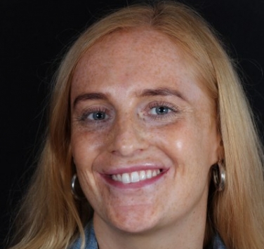 Smile Gallery - Church Road Dental and Cosmetic