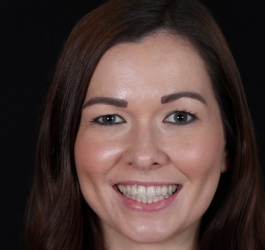 Smile Gallery - Church Road Dental and Cosmetic
