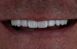 Smile Gallery - Church Road Dental and Cosmetic