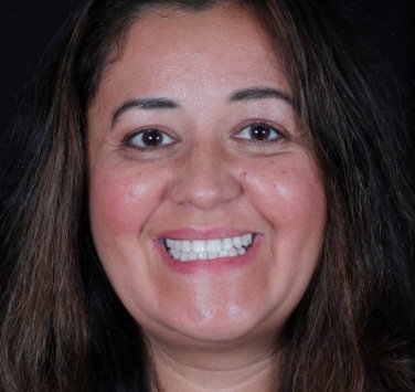 Smile Gallery - Church Road Dental and Cosmetic
