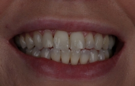 Smile Gallery - Church Road Dental and Cosmetic