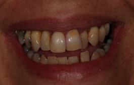 Smile Gallery - Church Road Dental and Cosmetic