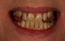 Smile Gallery - Church Road Dental and Cosmetic