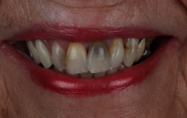 Smile Gallery - Church Road Dental and Cosmetic