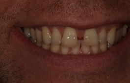 Smile Gallery - Church Road Dental and Cosmetic