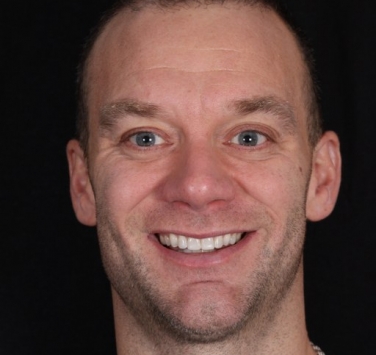 Smile Gallery - Church Road Dental and Cosmetic