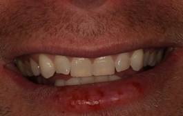 Smile Gallery - Church Road Dental and Cosmetic
