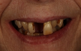 Smile Gallery - Church Road Dental and Cosmetic