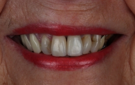 Smile Gallery - Church Road Dental and Cosmetic